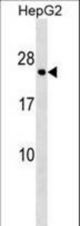 HLA-DPA1 Antibody western blot of HepG2 cell line lysates (35 ug/lane). The HLA-DPA1 antibody detected the HLA-DPA1 protein (arrow).