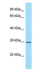HLA-DPB1 antibody Western Blot of ACHN.