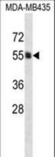 PIGA Antibody western blot of MDA-MB435 cell line lysates (35 ug/lane). The PIGA antibody detected the PIGA protein (arrow).