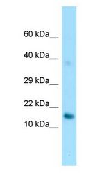 GPIHBP1 antibody Western Blot of HepG2.