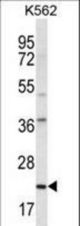 HLA-DQA1 Antibody western blot of K562 cell line lysates (35 ug/lane). The HLA-DQA1 antibody detected the HLA-DQA1 protein (arrow).