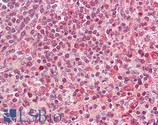 Anti-HLA-DQA2 antibody IHC of human spleen. Immunohistochemistry of formalin-fixed, paraffin-embedded tissue after heat-induced antigen retrieval. Antibody LS-B7406 concentration 3.75 ug/ml.