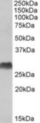 HLA-DQA2 antibody (1 ug/ml) staining of Human Bone Marrow lysate (35 ug protein/ml in RIPA buffer). Primary incubation was 1 hour. Detected by chemiluminescence.