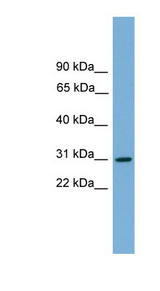 HLA-DQA2 antibody LS-C116374 Western blot of Fetal Brain lysate.