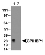 Detection of Gpihbp1 in transfected lysate (Lane 1). AN empty vector lysate was used as a negative control (Lane 2).