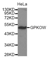 Western blot analysis of extracts of HeLa cell line, using GPKOW antibody.
