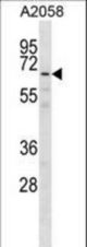 GPKOW Antibody western blot of A2058 cell line lysates (35 ug/lane). The GPKOW antibody detected the GPKOW protein (arrow).