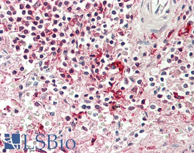Human Spleen: Formalin-Fixed, Paraffin-Embedded (FFPE)