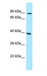 GPLD1 / GPIPLD antibody Western Blot of 721_B.