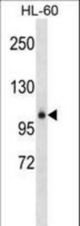GPLD1 Antibody western blot of HL-60 cell line lysates (35 ug/lane). The GPLD1 antibody detected the GPLD1 protein (arrow).