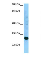 HLA-DRB3 antibody LS-C146376 Western blot of U937 Cell lysate. Antibody concentration 1 ug/ml.
