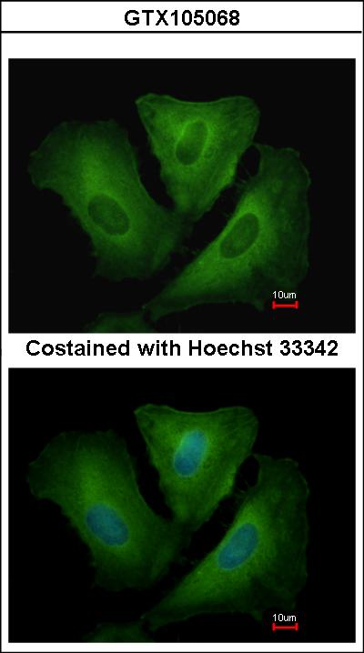 Immunofluorescence of methanol-fixed A549 using HLA-DRB3 antibody at 1:500 dilution.