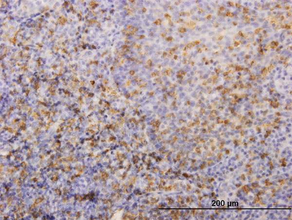 Immunoperoxidase of monoclonal antibody to HLA-DRB4 on formalin-fixed paraffin-embedded human tonsil. [antibody concentration 1 ug/ml]