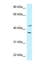 HLA-E antibody LS-C145964 Western blot of MCF7 Cell lysate. Antibody concentration 1 ug/ml.