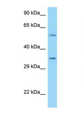 HLA-E antibody LS-C146160 Western blot of U937 Cell lysate. Antibody concentration 1 ug/ml.