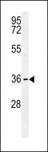 HLA-F Antibody western blot of MDA-MB231 cell line lysates (35 ug/lane). The HLA-F antibody detected the HLA-F protein (arrow).