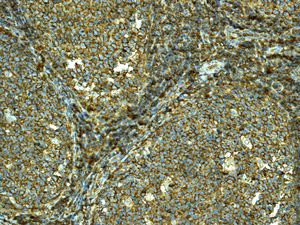 IHC of paraffin-embedded human tonsil tissue using anti-HLA-F antibody.