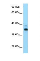 HLA-G antibody LS-C146241 Western blot of 8226 Cell lysate. Antibody concentration 1 ug/ml.
