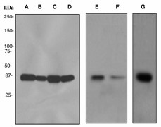 Western blot analysis on (A) 293T, (B) SH-SY5Y, (C) HepG2, (D) HeLa, (E) fetal kidney, (F) fetal liver and (G) fetal brain lysates using anti-HLF antibody (LS-C105618).