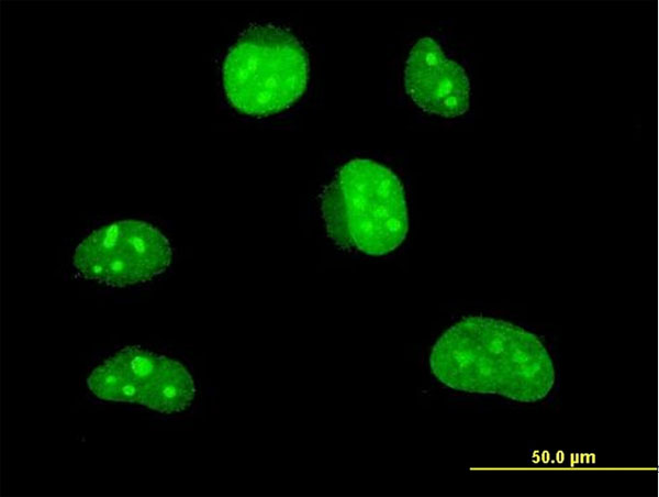 Immunofluorescence of monoclonal antibody to HLF on HeLa cell . [antibody concentration 10 ug/ml]