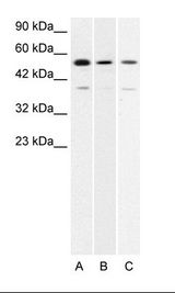 A. Jurkat Cell Lysate B. HepG2 Cell Lysate