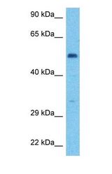 Western blot of HLX Antibody with human 721_B Whole Cell lysate.