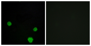 Immunofluorescence of MCF7 cells, using HLX1 Antibody. The picture on the right is treated with the synthesized peptide.