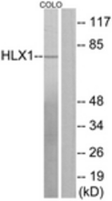 Western blot of extracts from COLO205 cells, using HLX1 Antibody. The lane on the right is treated with the synthesized peptide.