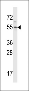 HM13 Antibody western blot of HeLa cell line lysates (35 ug/lane). The HM13 antibody detected the HM13 protein (arrow).