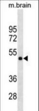 HMBOX1 Antibody western blot of mouse brain tissue lysates (35 ug/lane). The HMBOX1 antibody detected the HMBOX1 protein (arrow).