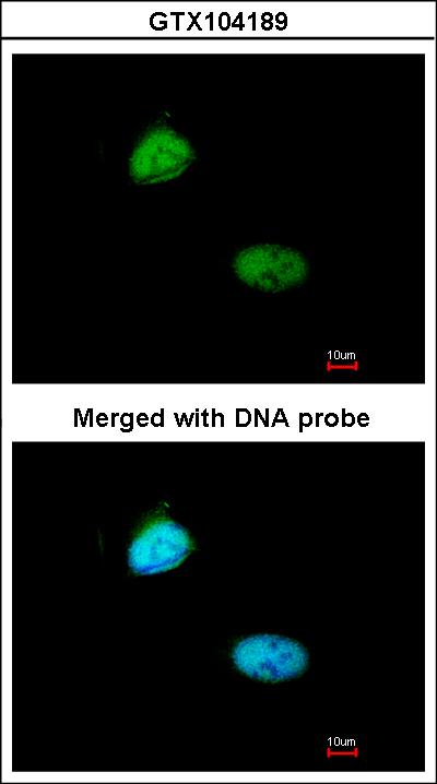 Immunofluorescence of paraformaldehyde-fixed HeLa using Homeobox-containing protein 1 antibody at 1:200 dilution.