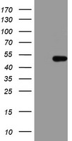 HEK293T cells were transfected with the pCMV6-ENTRY control (Left lane) or pCMV6-ENTRY HMBS (Right lane) cDNA for 48 hrs and lysed. Equivalent amounts of cell lysates (5 ug per lane) were separated by SDS-PAGE and immunoblotted with anti-HMBS.