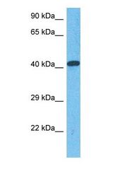 Western blot of HEM3 Antibody with human Fetal Lung lysate.