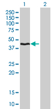 Western Blot analysis of HMBS expression in transfected 293T cell line by HMBS monoclonal antibody (M01), clone 3E8.Lane 1: HMBS transfected lysate(39.71 KDa).Lane 2: Non-transfected lysate.