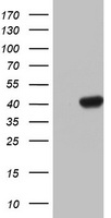HEK293T cells were transfected with the pCMV6-ENTRY control (Left lane) or pCMV6-ENTRY HMBS (Right lane) cDNA for 48 hrs and lysed. Equivalent amounts of cell lysates (5 ug per lane) were separated by SDS-PAGE and immunoblotted with anti-HMBS.