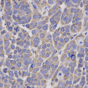 Immunohistochemistry of paraffin-embedded human kidney using IL23R antibody at dilution of 1:200 (x400 lens)