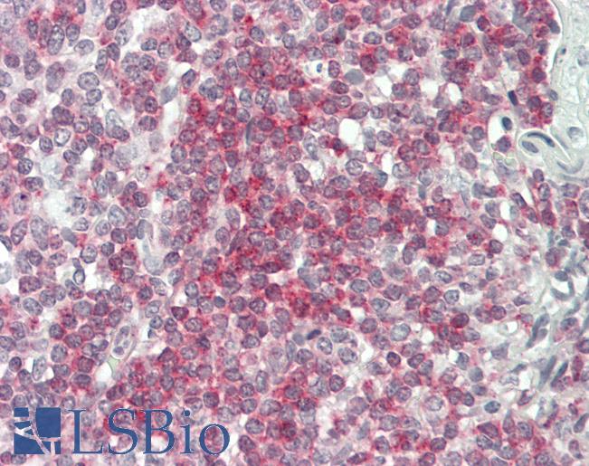 Human Tonsil: Formalin-Fixed, Paraffin-Embedded (FFPE)