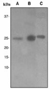 Western blot analysis on (A) SKBR-3, (B) HeLa and (C) Molt-4 cell lysates using anti-HMGB1 antibody, dilution 1:1000.