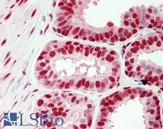 Human Prostate: Formalin-Fixed, Paraffin-Embedded (FFPE)