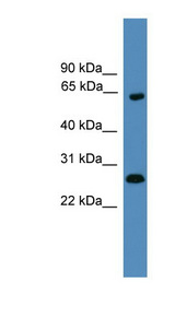HMGB1 antibody western blot of Human fetal kidney lysate.