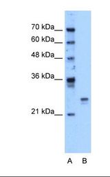 Lane A: Marker. Lane B: HepG2 cell lysate. Antibody concentration: 1.25 ug/ml. Gel concentration: 12%.