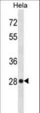 HMGB1 Antibody western blot of HeLa cell line lysates (35 ug/lane). The HMGB1 antibody detected the HMGB1 protein (arrow).
