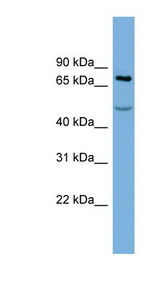 STIM1 antibody LS-C111031 Western blot of PANC1 cell lysate.