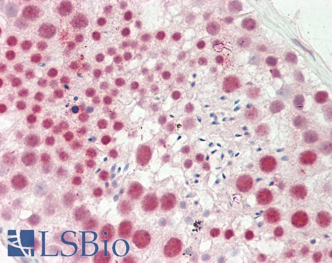 Human Testis: Formalin-Fixed, Paraffin-Embedded (FFPE)