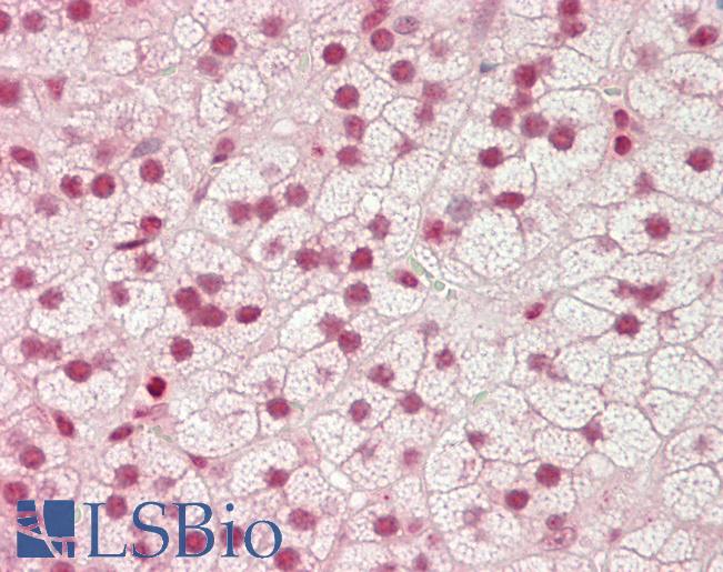 Human Adrenal: Formalin-Fixed, Paraffin-Embedded (FFPE)