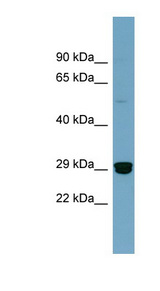 HMGB2 antibody western blot of COLO205 cell lysate.