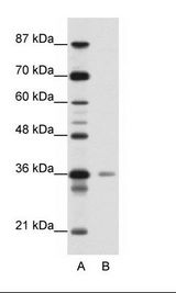 A: Marker, B: Jurkat Cell Lysate