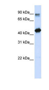 HMG20A antibody LS-C101753 Western blot of Transfected 293T cell lysate.