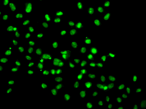 Immunofluorescence blot of MCF7 cell using HMG20A antibody.