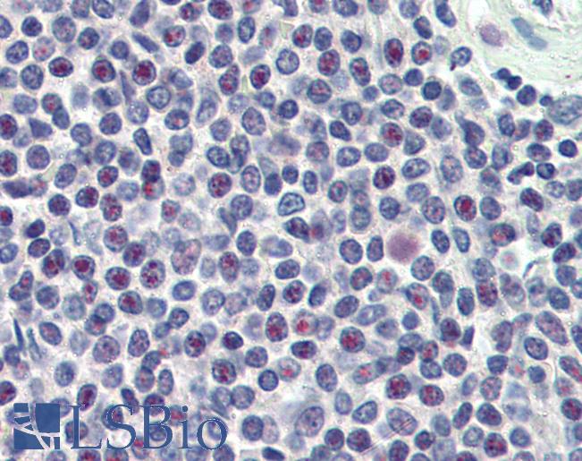 Anti-HMG20A antibody IHC of human spleen. Immunohistochemistry of formalin-fixed, paraffin-embedded tissue after heat-induced antigen retrieval. Antibody LS-B2490 concentration 5 ug/ml.